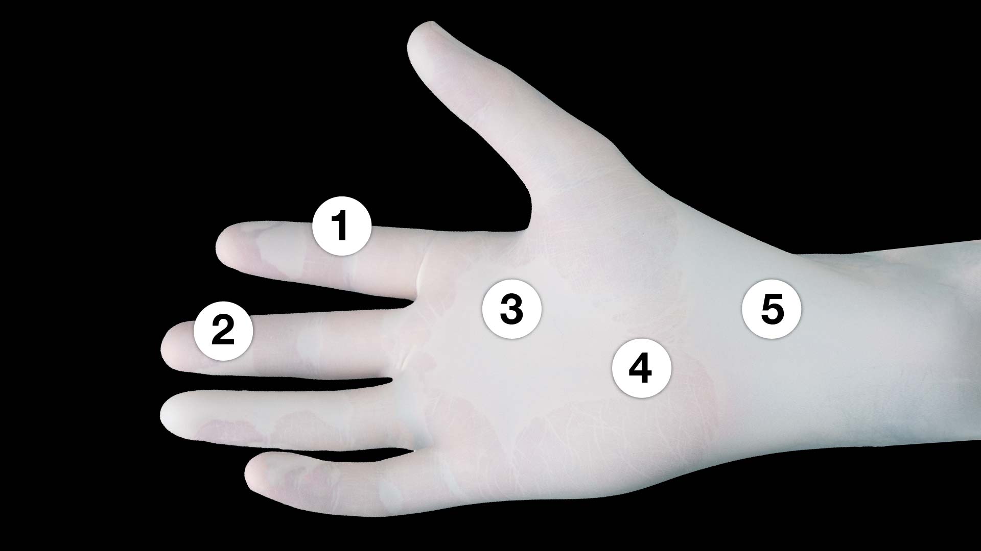 medical glove with numbers 1, 2, 3, 4, 5 for points